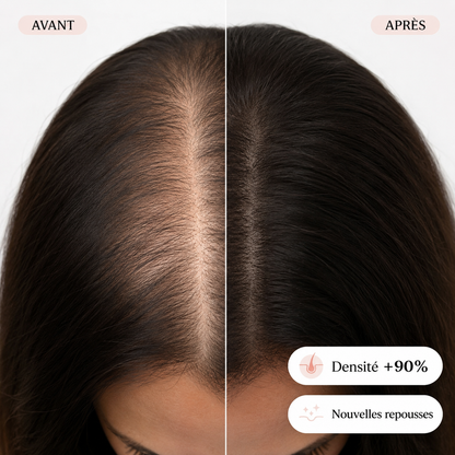 HairVitamin® : réparez enfin la source du problème: votre cuir chevelu, pour des cheveux longs, forts et beaux